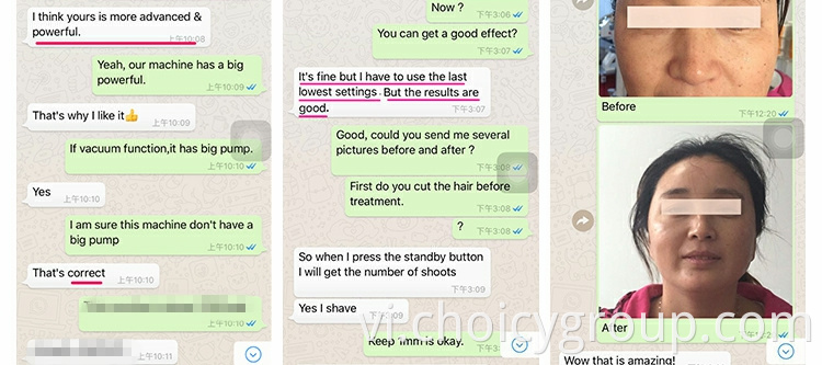 Feedback Of Ems Machine